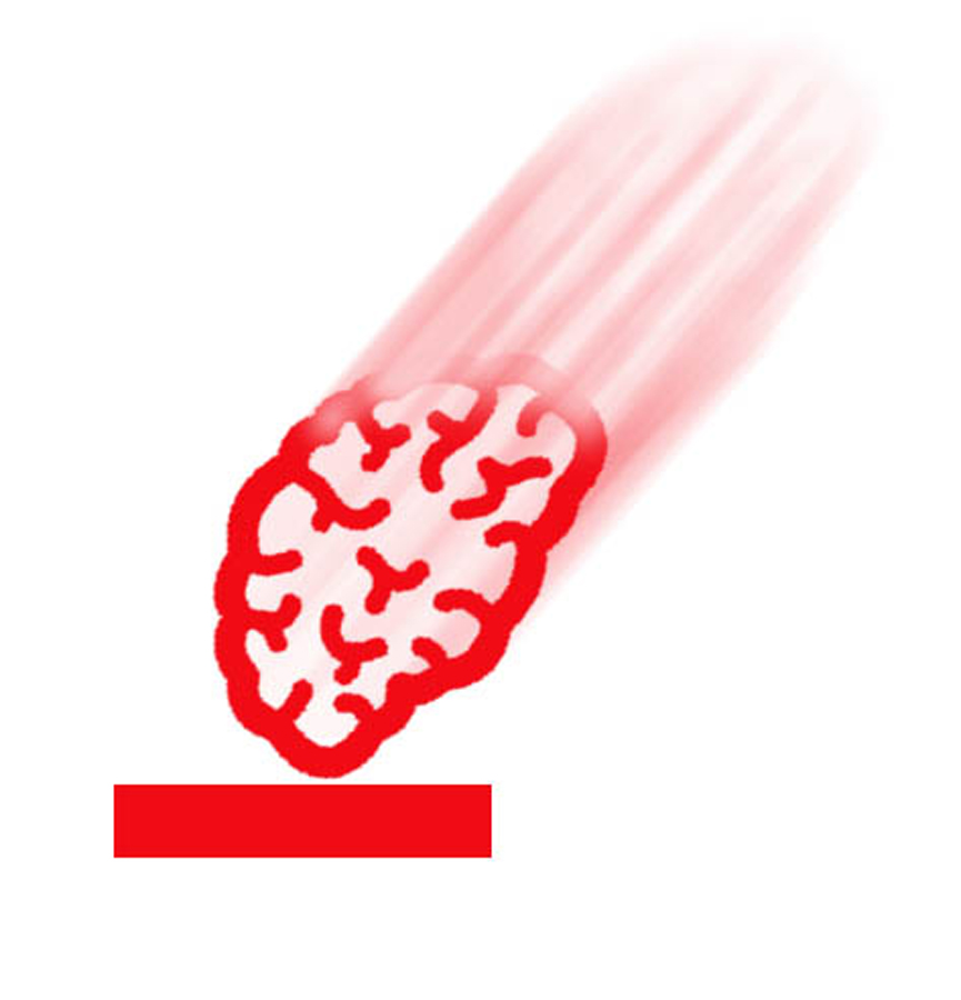 BrainPain2